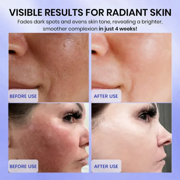 Skavix™ Radiglow Brightening Dark Spot Cream