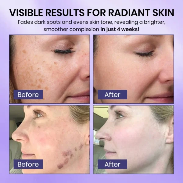 Skavix™ Radiglow Brightening Dark Spot Cream