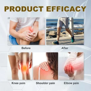 Skavix™ Soothes SkinNerve Soothing Cream