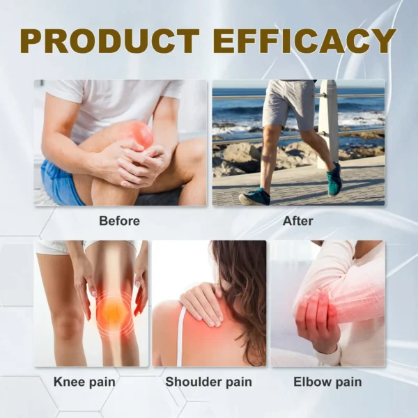 Skavix™ Soothes SkinNerve Soothing Cream