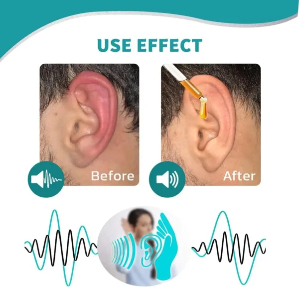 Skavix™ Ear Care Drops – Plant-Based Formula | FDA-Registered