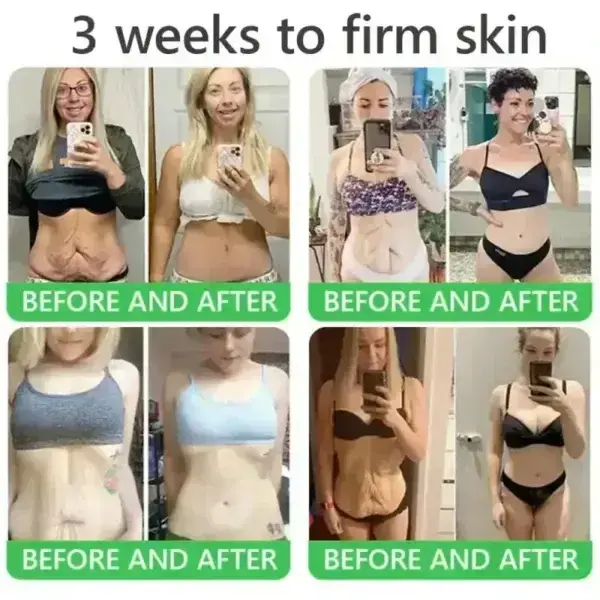 ๐๐ซ๐ข๐๐๐กยฎ ๐๐๐+ ๐-๐ข๐ง-๐ ๐๐๐ซ๐ฆ๐๐๐๐ฉ๐๐ข๐ซ ๐๐๐ซ๐ฎ๐ฆ ๐
๐๐ ๐๐๐ซ๐ญ๐ข๐๐ข๐๐ โ ๐
๐ข๐ซ๐ฆ๐ฌ ๐ฅ๐จ๐จ๐ฌ๐ ๐ฌ๐ค๐ข๐ง, ๐๐๐๐๐ฌ ๐๐ซ๐ฎ๐ข๐ฌ๐ข๐ง๐ ๐๐ง๐ ๐ฌ๐๐ง๐ข๐ฅ๐ ๐ฉ๐ฎ๐ซ๐ฉ๐ฎ๐ซ๐, ๐๐ง๐ ๐ข๐ฆ๐ฉ๐ซ๐จ๐ฏ๐๐ฌ ๐ค๐๐ซ๐๐ญ๐ข๐ง ๐๐ฎ๐ข๐ฅ๐๐ฎ๐ฉ, ๐ฌ๐๐๐จ๐ซ๐ซ๐ก๐๐ข๐ ๐๐๐ซ๐ฆ๐๐ญ๐ข๐ญ๐ข๐ฌ, ๐๐ง๐ ๐๐จ๐ฅ๐ฅ๐ข๐๐ฎ๐ฅ๐๐ซ ๐ค๐๐ซ๐๐ญ๐จ๐ฌ๐ข๐ฌ.