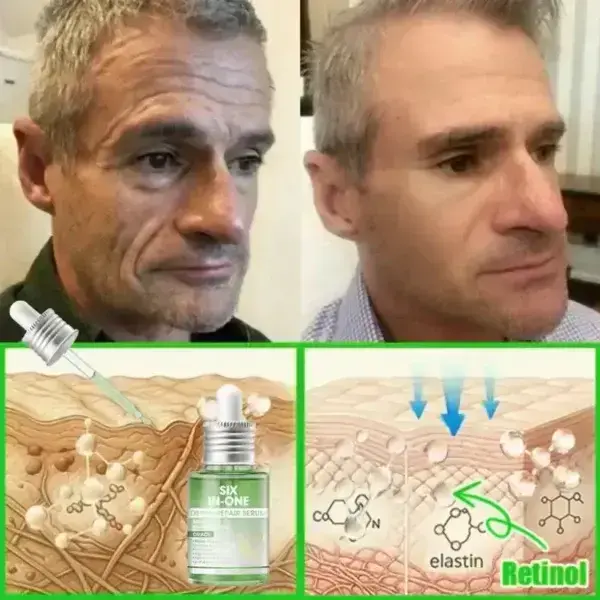 ๐๐ซ๐ข๐๐๐กยฎ ๐๐๐+ ๐-๐ข๐ง-๐ ๐๐๐ซ๐ฆ๐๐๐๐ฉ๐๐ข๐ซ ๐๐๐ซ๐ฎ๐ฆ ๐
๐๐ ๐๐๐ซ๐ญ๐ข๐๐ข๐๐ โ ๐
๐ข๐ซ๐ฆ๐ฌ ๐ฅ๐จ๐จ๐ฌ๐ ๐ฌ๐ค๐ข๐ง, ๐๐๐๐๐ฌ ๐๐ซ๐ฎ๐ข๐ฌ๐ข๐ง๐ ๐๐ง๐ ๐ฌ๐๐ง๐ข๐ฅ๐ ๐ฉ๐ฎ๐ซ๐ฉ๐ฎ๐ซ๐, ๐๐ง๐ ๐ข๐ฆ๐ฉ๐ซ๐จ๐ฏ๐๐ฌ ๐ค๐๐ซ๐๐ญ๐ข๐ง ๐๐ฎ๐ข๐ฅ๐๐ฎ๐ฉ, ๐ฌ๐๐๐จ๐ซ๐ซ๐ก๐๐ข๐ ๐๐๐ซ๐ฆ๐๐ญ๐ข๐ญ๐ข๐ฌ, ๐๐ง๐ ๐๐จ๐ฅ๐ฅ๐ข๐๐ฎ๐ฅ๐๐ซ ๐ค๐๐ซ๐๐ญ๐จ๐ฌ๐ข๐ฌ.