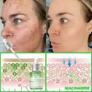 ๐๐ซ๐ข๐๐๐กยฎ ๐๐๐+ ๐-๐ข๐ง-๐ ๐๐๐ซ๐ฆ๐๐๐๐ฉ๐๐ข๐ซ ๐๐๐ซ๐ฎ๐ฆ ๐
๐๐ ๐๐๐ซ๐ญ๐ข๐๐ข๐๐ โ ๐
๐ข๐ซ๐ฆ๐ฌ ๐ฅ๐จ๐จ๐ฌ๐ ๐ฌ๐ค๐ข๐ง, ๐๐๐๐๐ฌ ๐๐ซ๐ฎ๐ข๐ฌ๐ข๐ง๐ ๐๐ง๐ ๐ฌ๐๐ง๐ข๐ฅ๐ ๐ฉ๐ฎ๐ซ๐ฉ๐ฎ๐ซ๐, ๐๐ง๐ ๐ข๐ฆ๐ฉ๐ซ๐จ๐ฏ๐๐ฌ ๐ค๐๐ซ๐๐ญ๐ข๐ง ๐๐ฎ๐ข๐ฅ๐๐ฎ๐ฉ, ๐ฌ๐๐๐จ๐ซ๐ซ๐ก๐๐ข๐ ๐๐๐ซ๐ฆ๐๐ญ๐ข๐ญ๐ข๐ฌ, ๐๐ง๐ ๐๐จ๐ฅ๐ฅ๐ข๐๐ฎ๐ฅ๐๐ซ ๐ค๐๐ซ๐๐ญ๐จ๐ฌ๐ข๐ฌ.