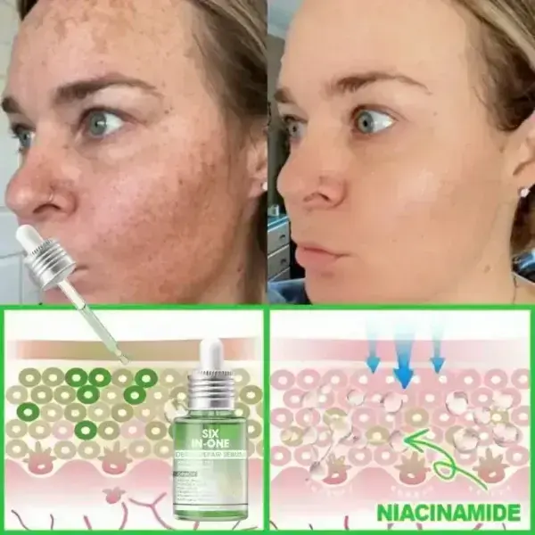 ๐๐ซ๐ข๐๐๐กยฎ ๐๐๐+ ๐-๐ข๐ง-๐ ๐๐๐ซ๐ฆ๐๐๐๐ฉ๐๐ข๐ซ ๐๐๐ซ๐ฎ๐ฆ ๐
๐๐ ๐๐๐ซ๐ญ๐ข๐๐ข๐๐ โ ๐
๐ข๐ซ๐ฆ๐ฌ ๐ฅ๐จ๐จ๐ฌ๐ ๐ฌ๐ค๐ข๐ง, ๐๐๐๐๐ฌ ๐๐ซ๐ฎ๐ข๐ฌ๐ข๐ง๐ ๐๐ง๐ ๐ฌ๐๐ง๐ข๐ฅ๐ ๐ฉ๐ฎ๐ซ๐ฉ๐ฎ๐ซ๐, ๐๐ง๐ ๐ข๐ฆ๐ฉ๐ซ๐จ๐ฏ๐๐ฌ ๐ค๐๐ซ๐๐ญ๐ข๐ง ๐๐ฎ๐ข๐ฅ๐๐ฎ๐ฉ, ๐ฌ๐๐๐จ๐ซ๐ซ๐ก๐๐ข๐ ๐๐๐ซ๐ฆ๐๐ญ๐ข๐ญ๐ข๐ฌ, ๐๐ง๐ ๐๐จ๐ฅ๐ฅ๐ข๐๐ฎ๐ฅ๐๐ซ ๐ค๐๐ซ๐๐ญ๐จ๐ฌ๐ข๐ฌ.