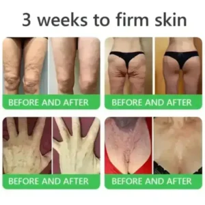 ๐๐ซ๐ข๐๐๐กยฎ ๐๐๐+ ๐-๐ข๐ง-๐ ๐๐๐ซ๐ฆ๐๐๐๐ฉ๐๐ข๐ซ ๐๐๐ซ๐ฎ๐ฆ ๐
๐๐ ๐๐๐ซ๐ญ๐ข๐๐ข๐๐ โ ๐
๐ข๐ซ๐ฆ๐ฌ ๐ฅ๐จ๐จ๐ฌ๐ ๐ฌ๐ค๐ข๐ง, ๐๐๐๐๐ฌ ๐๐ซ๐ฎ๐ข๐ฌ๐ข๐ง๐ ๐๐ง๐ ๐ฌ๐๐ง๐ข๐ฅ๐ ๐ฉ๐ฎ๐ซ๐ฉ๐ฎ๐ซ๐, ๐๐ง๐ ๐ข๐ฆ๐ฉ๐ซ๐จ๐ฏ๐๐ฌ ๐ค๐๐ซ๐๐ญ๐ข๐ง ๐๐ฎ๐ข๐ฅ๐๐ฎ๐ฉ, ๐ฌ๐๐๐จ๐ซ๐ซ๐ก๐๐ข๐ ๐๐๐ซ๐ฆ๐๐ญ๐ข๐ญ๐ข๐ฌ, ๐๐ง๐ ๐๐จ๐ฅ๐ฅ๐ข๐๐ฎ๐ฅ๐๐ซ ๐ค๐๐ซ๐๐ญ๐จ๐ฌ๐ข๐ฌ.