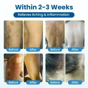 Cougex® PCA Magnesium Deep Repair Spray