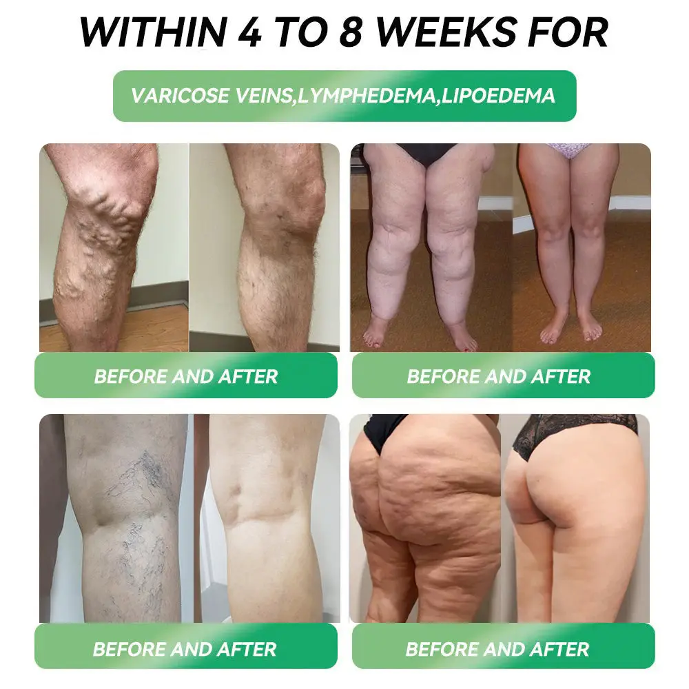 Croaie® Telpotide Oral Solution