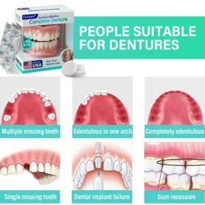 Ourlyard® Suction-fit Complete Denture