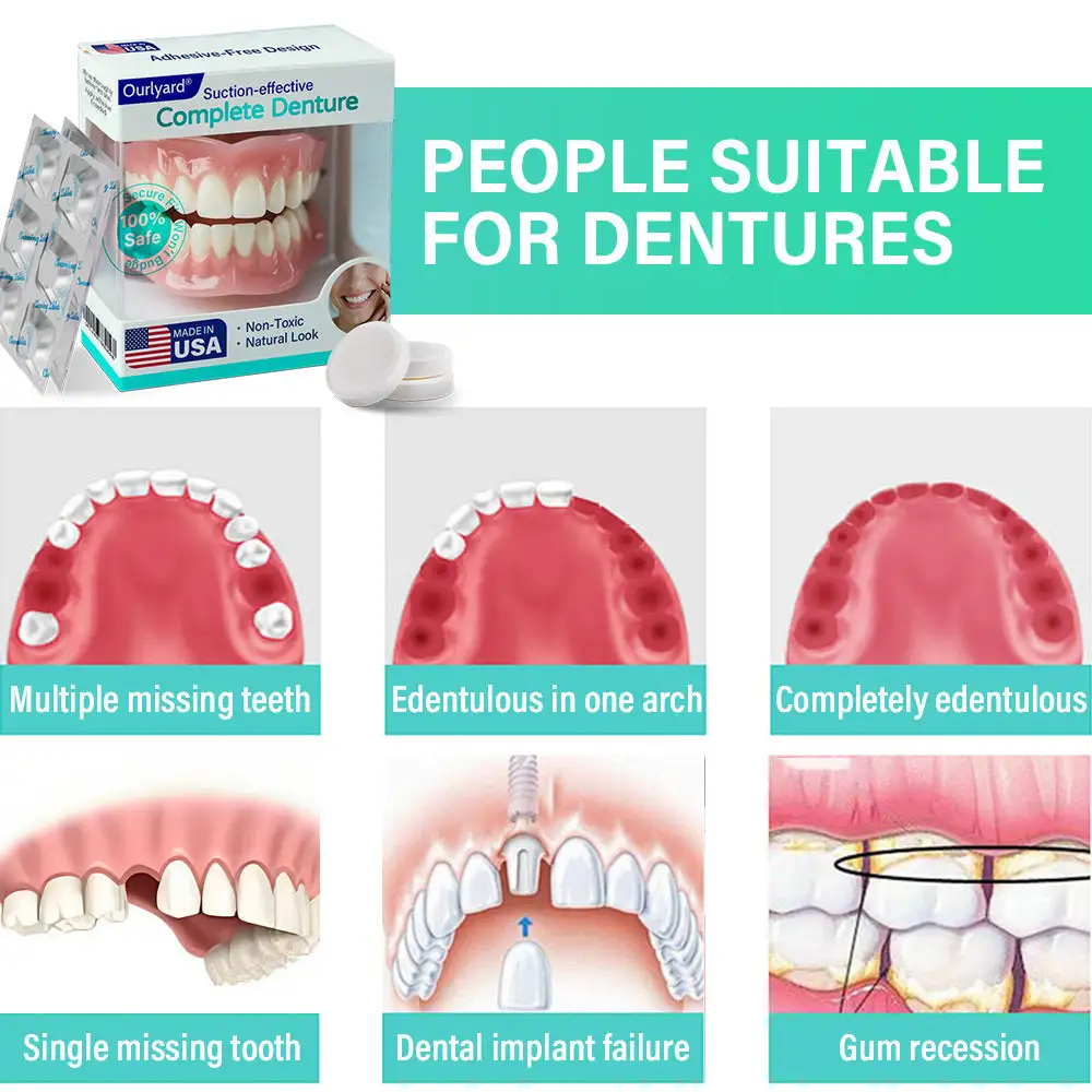Ourlyard® Suction-fit Complete Denture