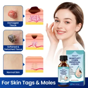 Skavix™ WartLift Corn Removal Liquid