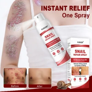 KUBOZN® Snail Repair Spray for Itchy, Flaky Psoriasis Skin