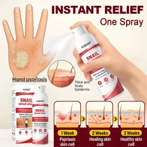 KUBOZN® Snail Repair Spray for Itchy, Flaky Psoriasis Skin
