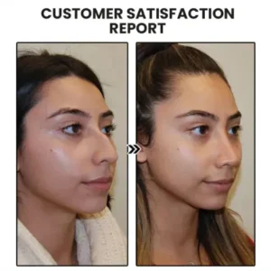 Skavix™ Miniyou Lymphatic Drainage Earrings