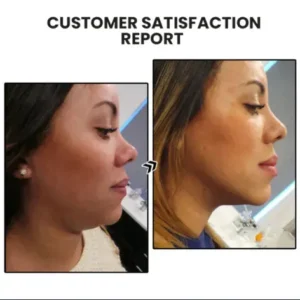 Skavix™ Miniyou Lymphatic Drainage Earrings