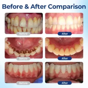 Biancat® BeeTakt Oral Repair Solution