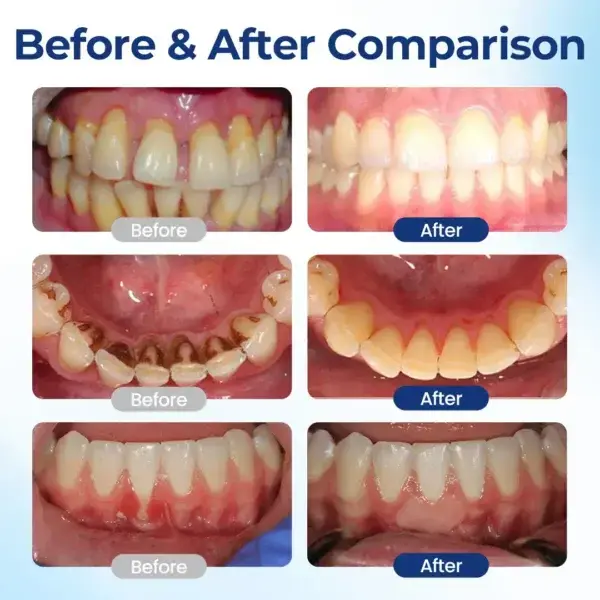 Biancat® BeeTakt Oral Repair Solution