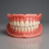 SEAGRIL™ Custom-Fit Full Functional Dentures