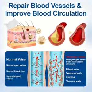 Skavix® 𝗩𝗲𝗶𝗻𝗧𝗮𝗿𝗴𝗲𝘁 𝗠𝗶𝗰𝗿𝗼𝗻𝗲𝗲𝗱𝗹𝗲 𝗣𝗮𝘁𝗰𝗵🌾🍻𝗜𝗻𝘀𝘁𝗮𝗻𝘁 𝗥𝗲𝗹𝗶𝗲𝗳, 𝗟𝗼𝗻𝗴-𝗧𝗲𝗿𝗺 𝗥𝗲𝘀𝘂𝗹𝘁𝘀✅🇺🇸