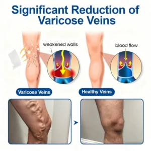 Skavix® 𝗩𝗲𝗶𝗻𝗧𝗮𝗿𝗴𝗲𝘁 𝗠𝗶𝗰𝗿𝗼𝗻𝗲𝗲𝗱𝗹𝗲 𝗣𝗮𝘁𝗰𝗵🌾🍻𝗜𝗻𝘀𝘁𝗮𝗻𝘁 𝗥𝗲𝗹𝗶𝗲𝗳, 𝗟𝗼𝗻𝗴-𝗧𝗲𝗿𝗺 𝗥𝗲𝘀𝘂𝗹𝘁𝘀✅🇺🇸