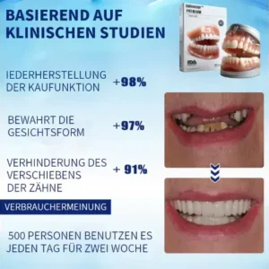 Smileasego™ – Premium-Zahnprothese