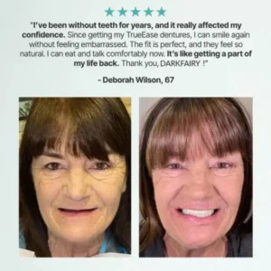 🔥DarkFairy™ Custom-Fit Dentures — Designed for Comfort and a Natural-Looking Smile