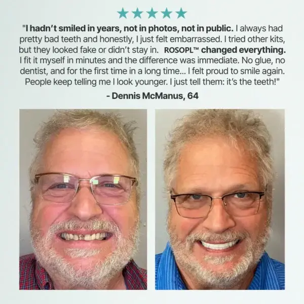 🦷HazyGalaxy™ Custom-Fit Functional Dentures — Made in the USA, Up to 70% OFF for a More Confident Smile!