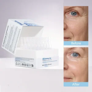 Skavix® 3% HA Serum 2026 | Deep Hydration Care