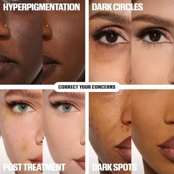 Skavix™ Calcium Eye Cream | Dark Circle Repair