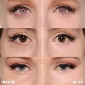 Skavix™ Calcium Eye Cream | Dark Circle Repair