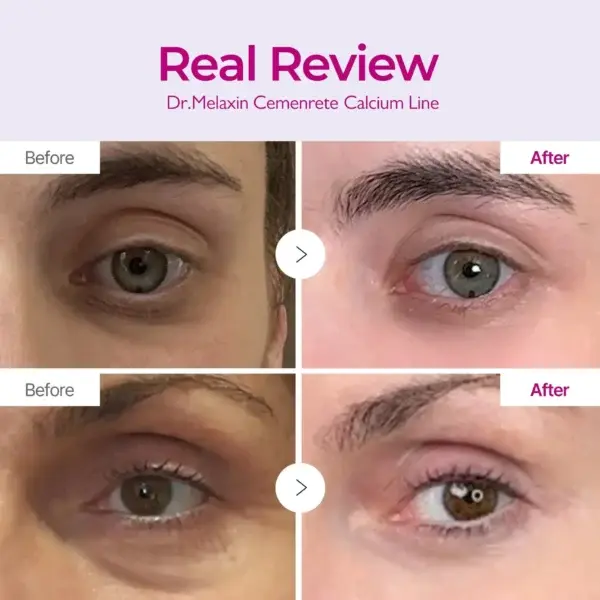 Skavix™ Calcium Eye Cream | Dark Circle Repair