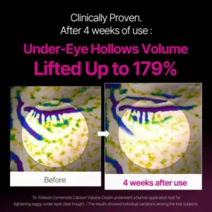 Skavix™ Calcium Eye Cream | Dark Circle Repair
