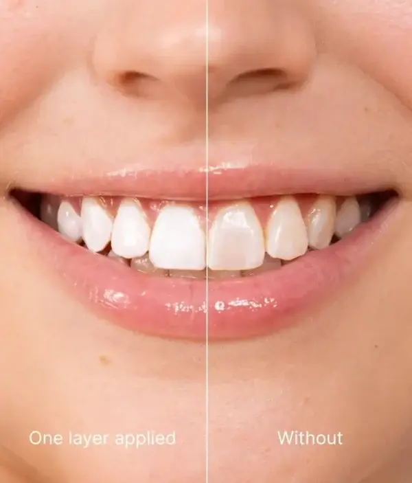 Skavix Tooth Polish 2026 | Instant White Smile