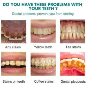 Skavix Tooth Polish 2026 | Instant White Smile