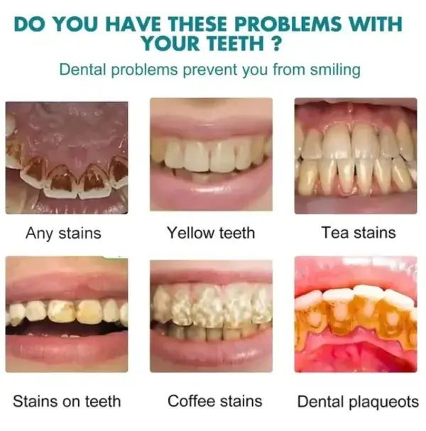 Skavix Tooth Polish 2026 | Instant White Smile