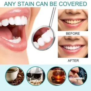 Skavix Tooth Polish 2026 | Instant White Smile