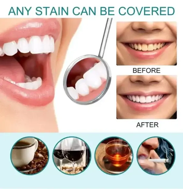 Skavix Tooth Polish 2026 | Instant White Smile