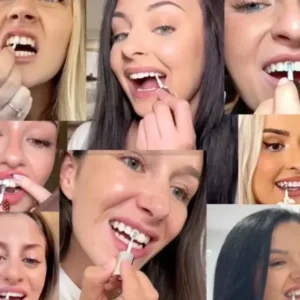 Skavix Tooth Polish 2026 | Instant White Smile