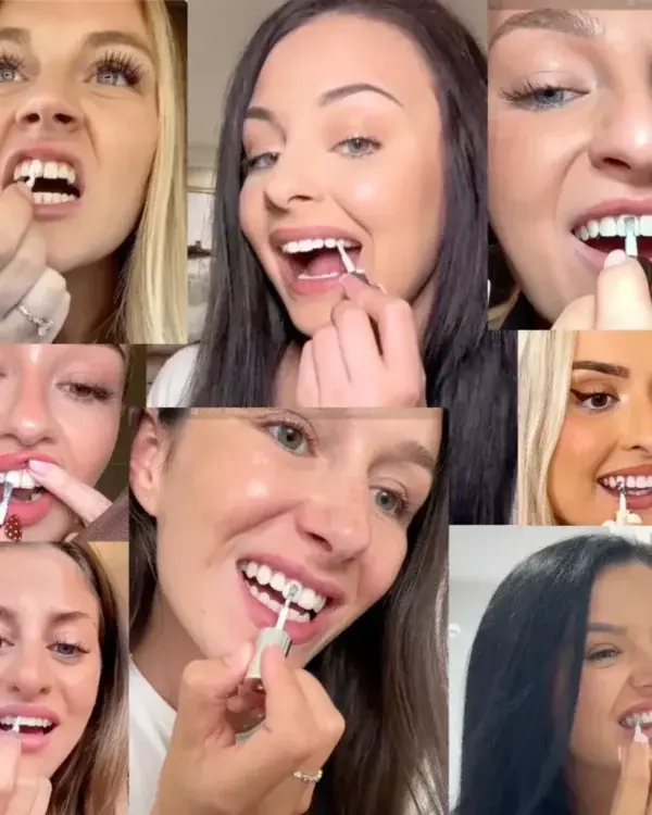Skavix Tooth Polish 2026 | Instant White Smile