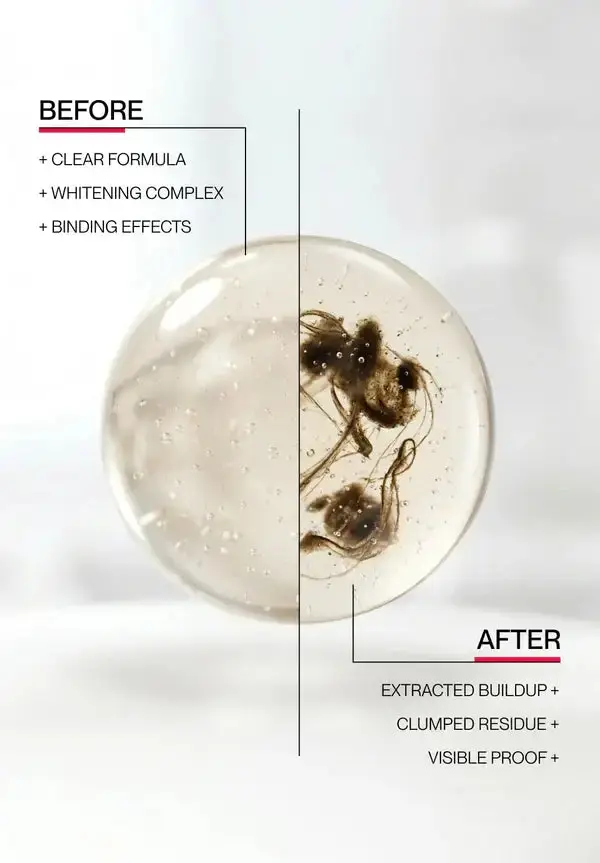 Skavix® Whitening Mouthwash | Fresh Breath