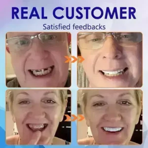 HEATWOLF Full Denture Set | Custom Fit Upper & Lower Dentures