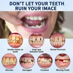 HEATWOLF Full Denture Set | Custom Fit Upper & Lower Dentures