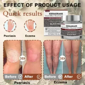KeraErase Dual-Effect Renewal Cream