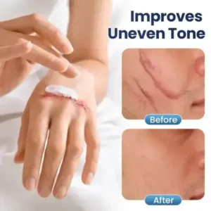 Nexisify® DERMALUX Texture Repair Gel