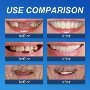 ROSOPL™ Custom-Fit Full Functional DenturesMake you more confident-Made in the USA